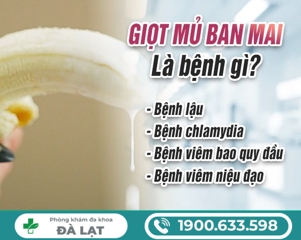 Hình ảnh minh họa